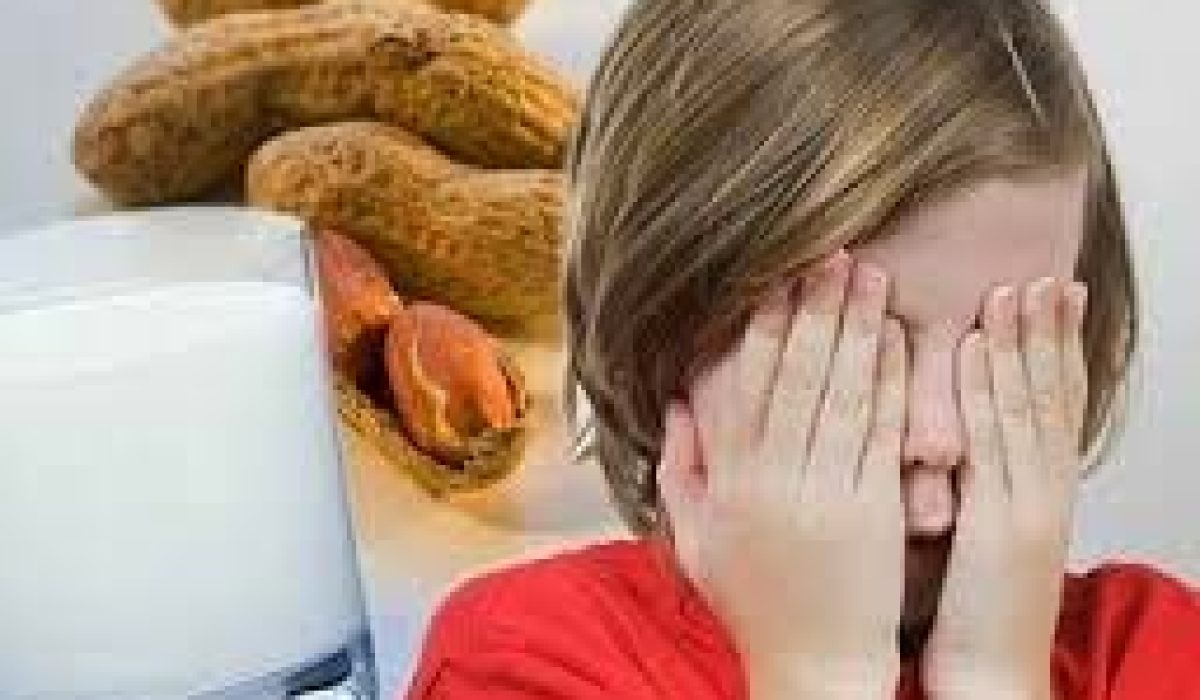 Cara Mengobati Alergi pada Makanan